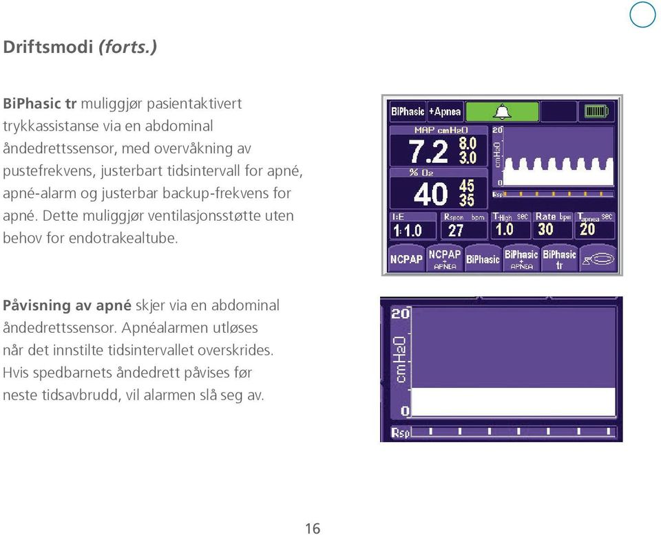 justerbart tidsintervall for apné, apné-alarm og justerbar backup-frekvens for apné.