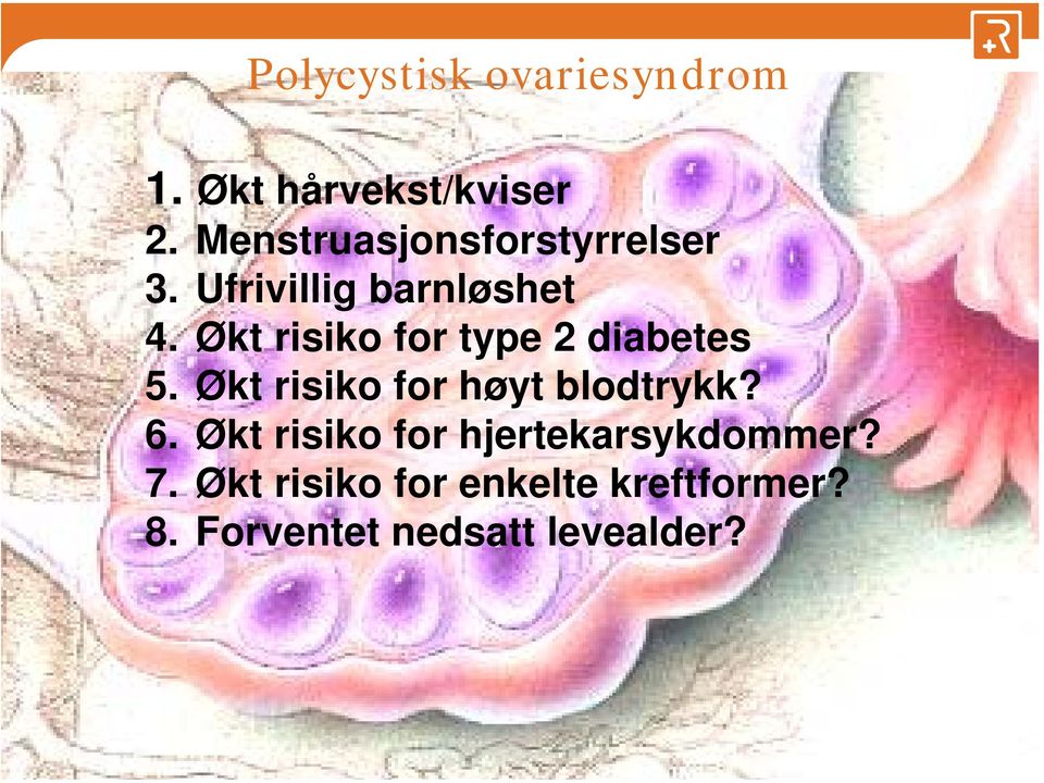 Økt risiko for type 2 diabetes 5. Økt risiko for høyt blodtrykk? 6.