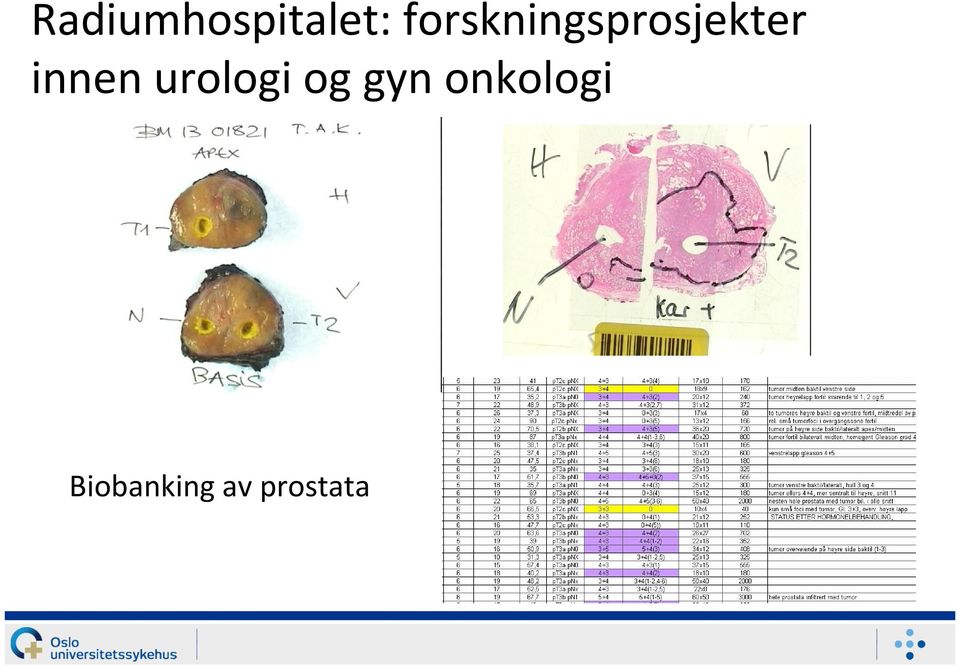 innen urologi og