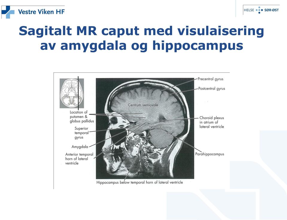 visulaisering