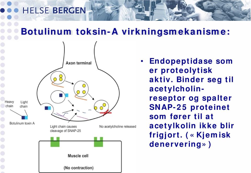 Binder seg til acetylcholinreseptor og spalter SNAP-25