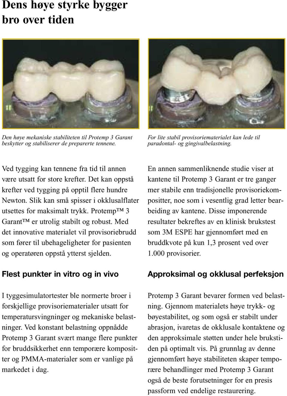 Det kan oppstå krefter ved tygging på opptil flere hundre Newton. Slik kan små spisser i okklusalflater utsettes for maksimalt trykk. Protemp 3 Garant er utrolig stabilt og robust.