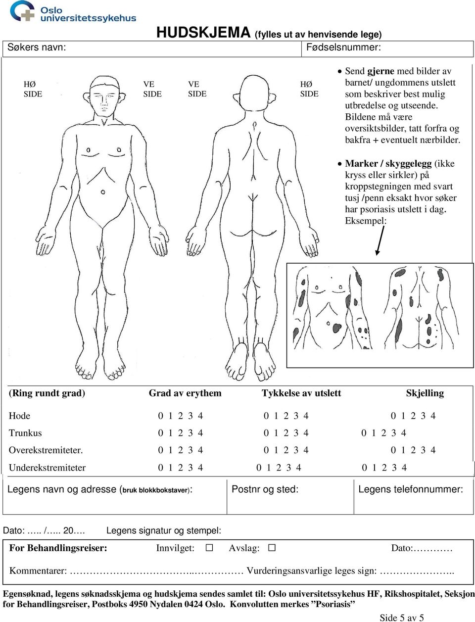 Marker / skyggelegg (ikke kryss eller sirkler) på kroppstegningen med svart tusj /penn eksakt hvor søker har psoriasis utslett i dag.