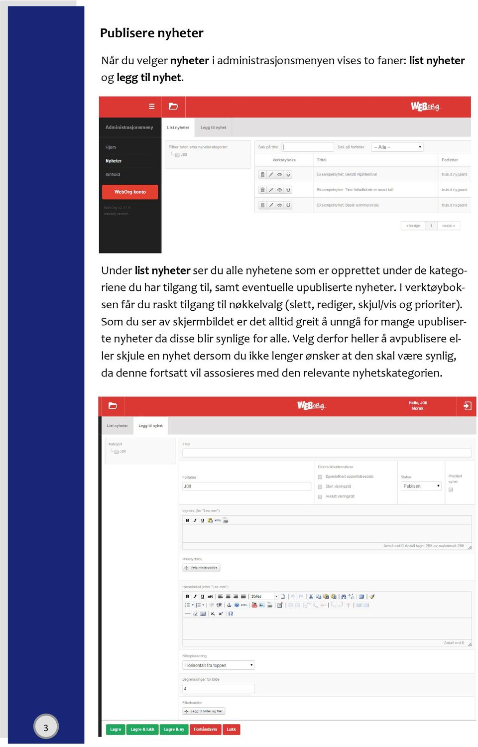 I verktøyboksen får du raskt tilgang til nøkkelvalg (slett, rediger, skjul/vis og prioriter).