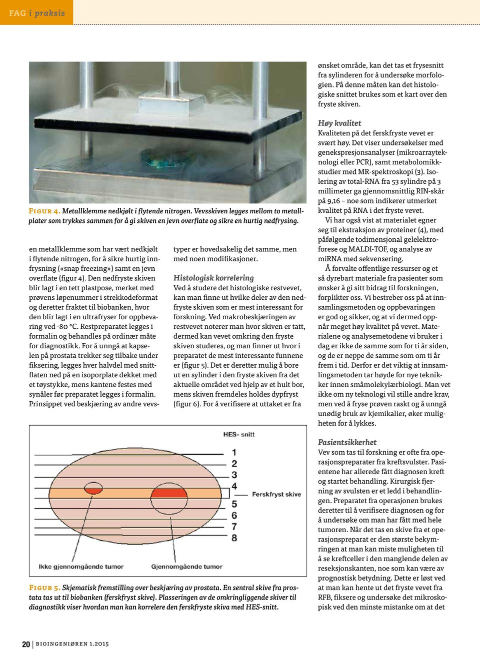 en metallklemme som har vært nedkjølt i flytende nitrogen, for å sikre hurtig innfrysning («snap freezing») samt en jevn overflate (figur 4).