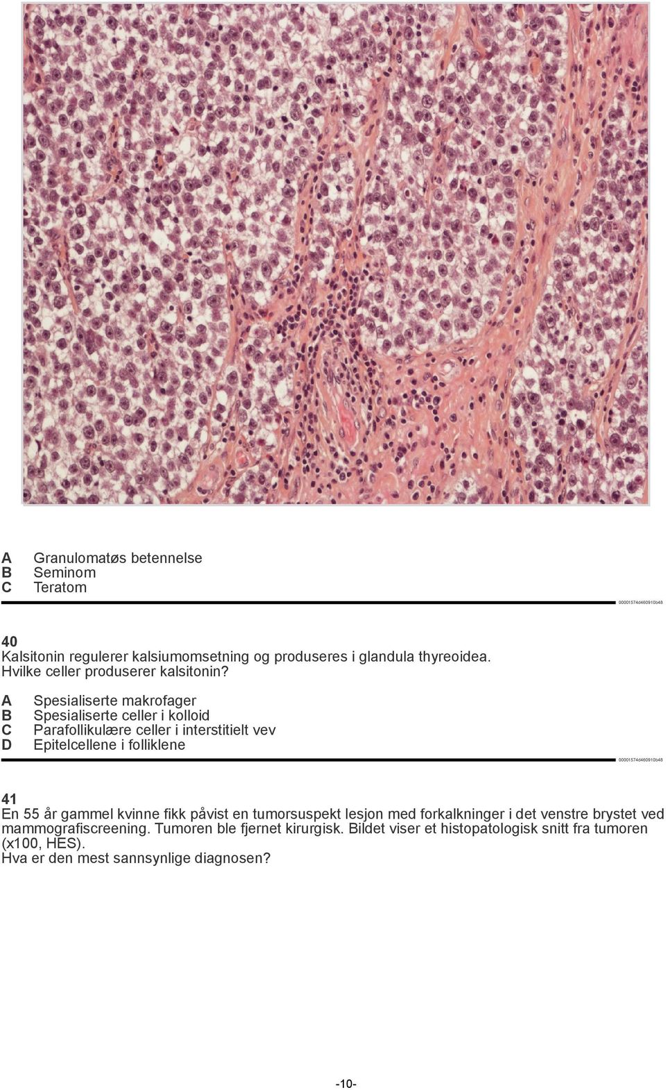 Spesialiserte makrofager Spesialiserte celler i kolloid Parafollikulære celler i interstitielt vev Epitelcellene i folliklene 41 En 55