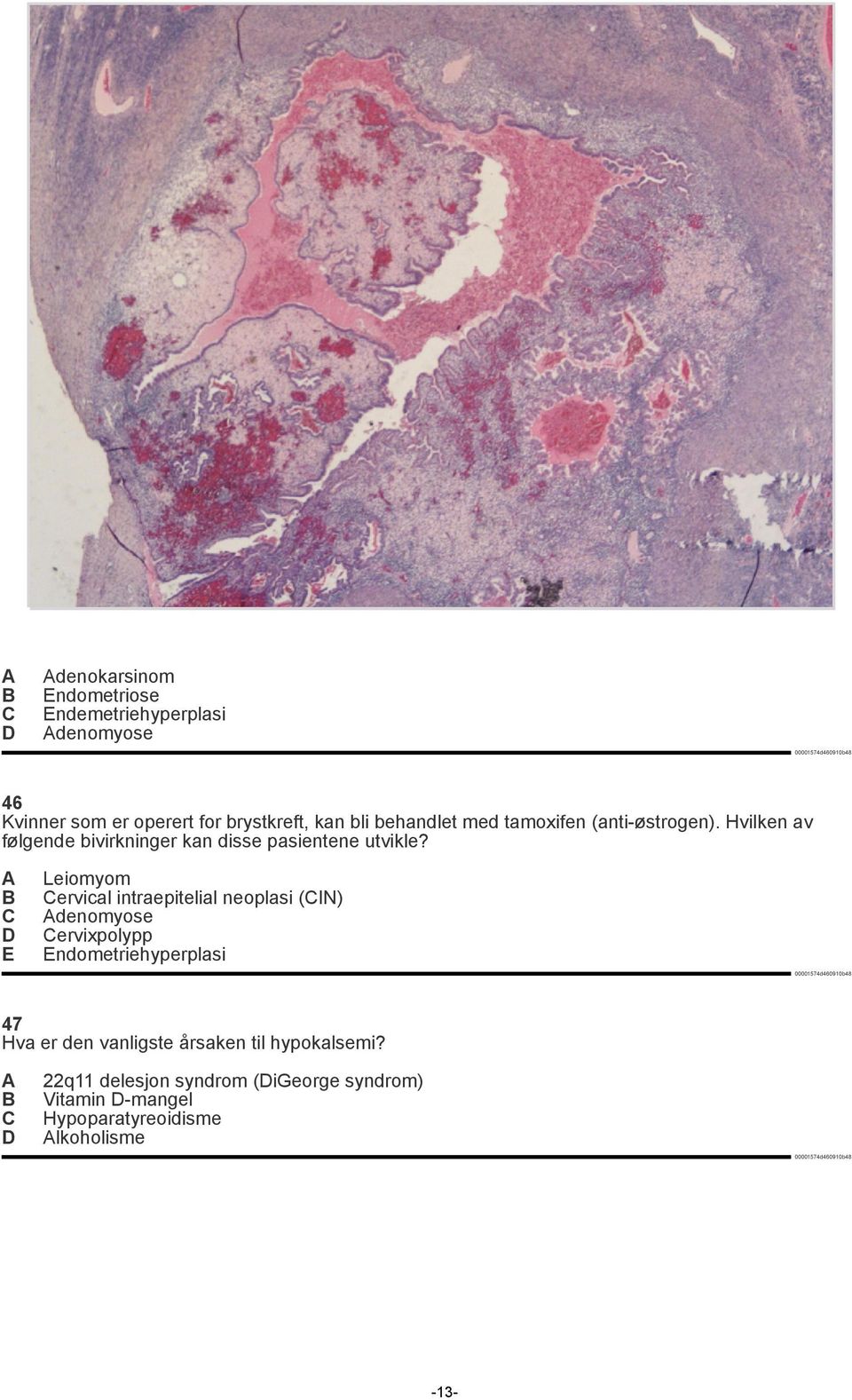 E Leiomyom ervical intraepitelial neoplasi (IN) denomyose ervixpolypp Endometriehyperplasi 47 Hva er den