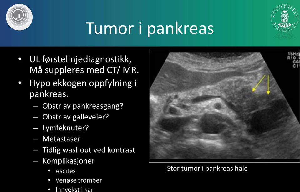 Obstr av galleveier? Lymfeknuter?