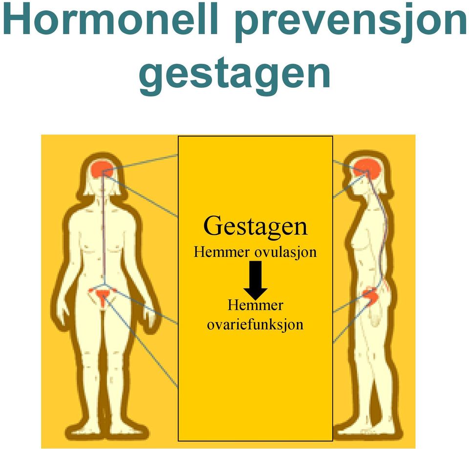 Gestagen Hemmer