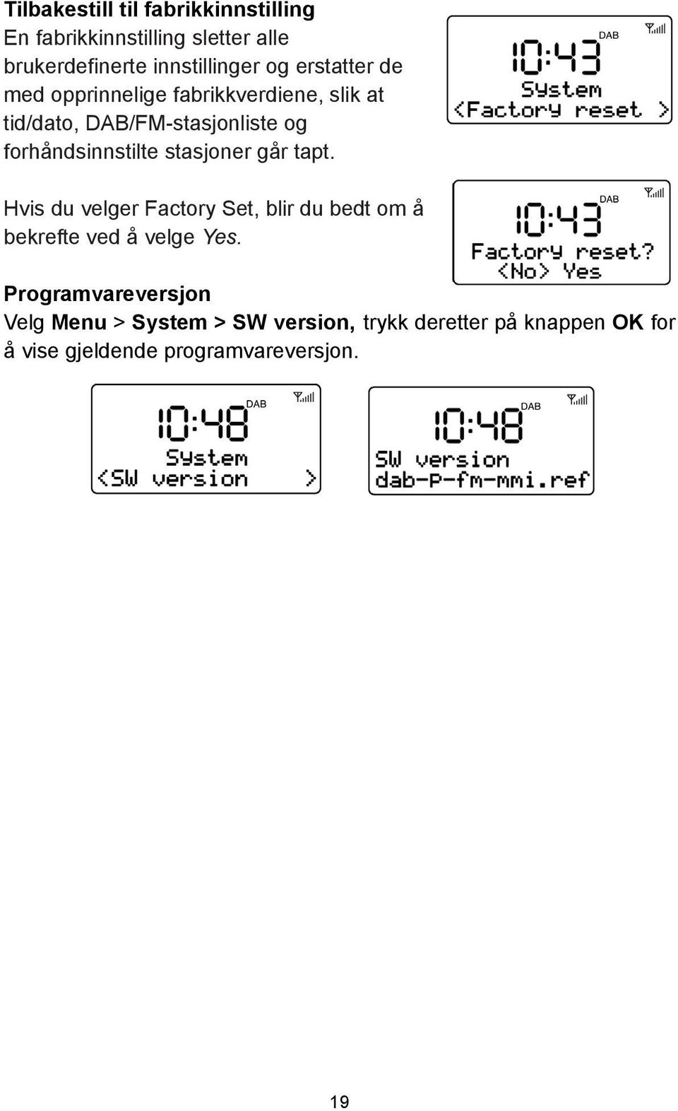 stasjoner går tapt. Hvis du velger Factory Set, blir du bedt om å bekrefte ved å velge Yes.