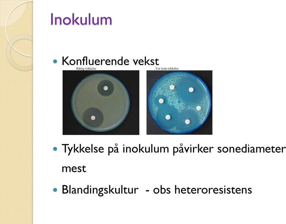 påvirker sonediameter mest