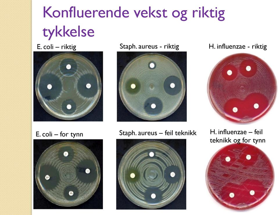 influenzae - riktig E. coli for tynn Staph.