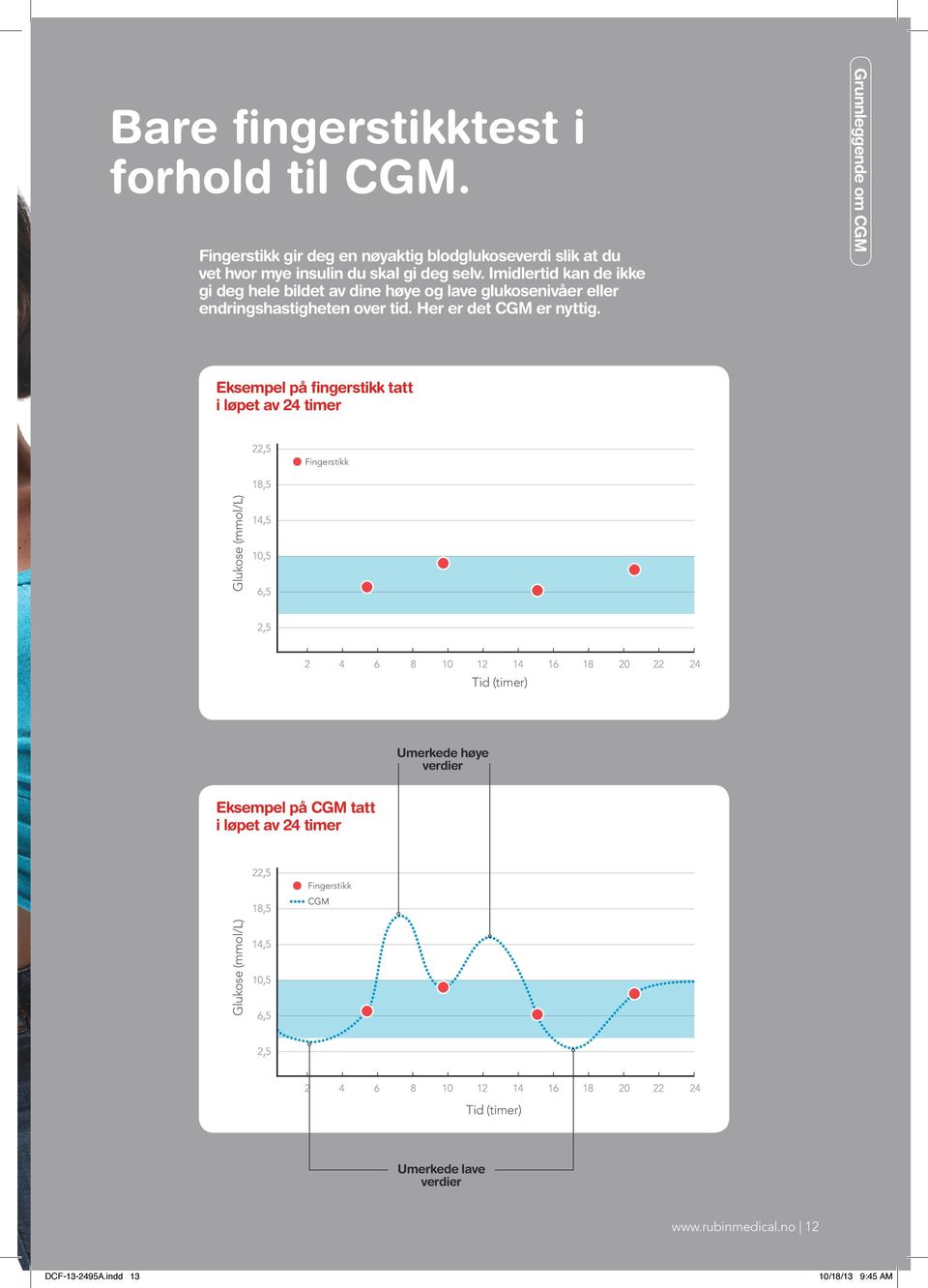 Grunnleggende om CGM Eksempel på fingerstikk tatt i løpet av 24 timer Fingerstikk Glukose (mmol/l) Tid (timer) Umerkede høye verdier Eksempel på CGM tatt i løpet av 24 timer Glukose