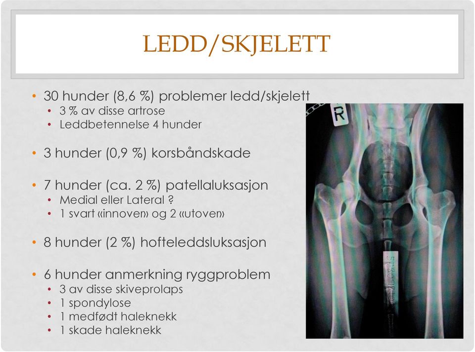 2 %) patellaluksasjon Medial eller Lateral?