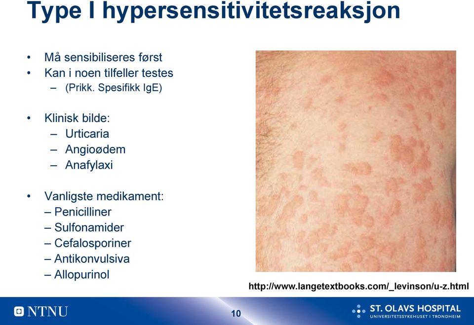 Spesifikk IgE) Klinisk bilde: Urticaria Angioødem Anafylaxi Vanligste