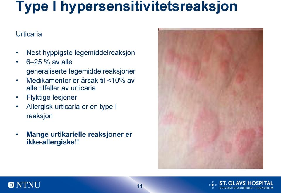 Medikamenter er årsak til <10% av alle tilfeller av urticaria Flyktige