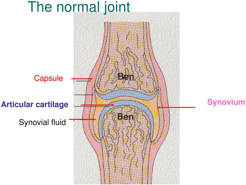 Articular