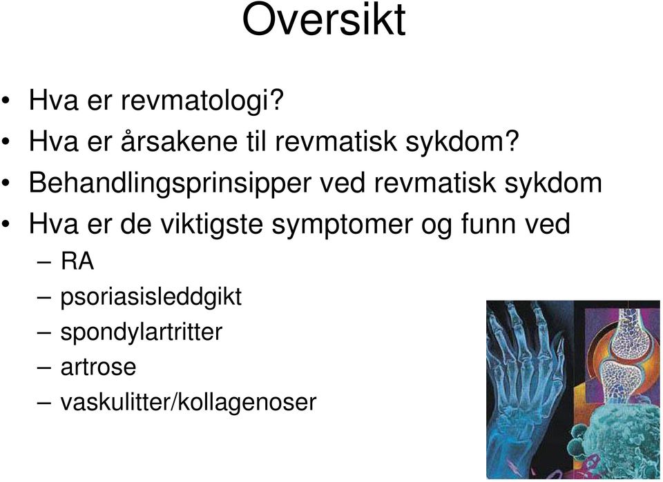 Behandlingsprinsipper ved revmatisk sykdom Hva er de