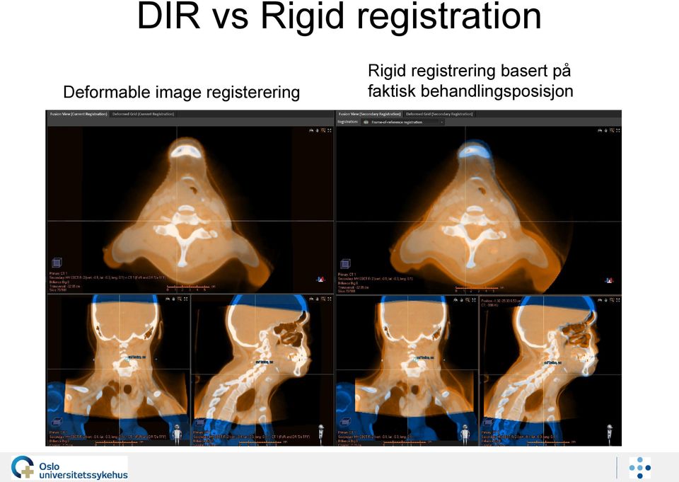 registerering Rigid