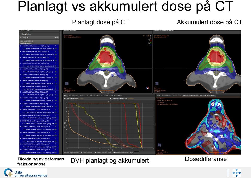 CT Tilordning av deformert