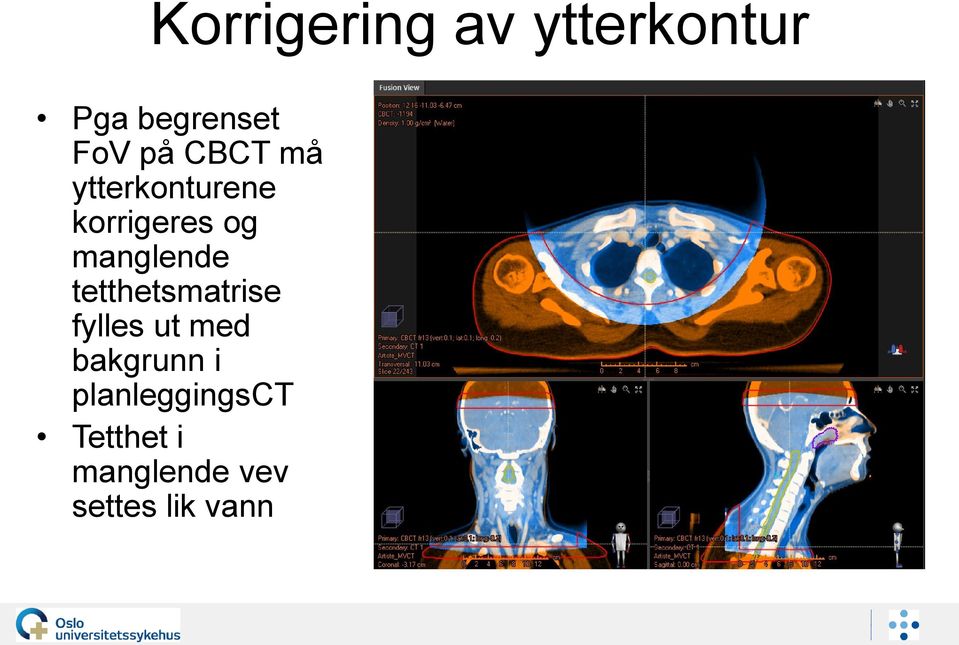 tetthetsmatrise fylles ut med bakgrunn i