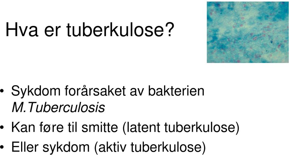 Tuberculosis Kan føre til smitte