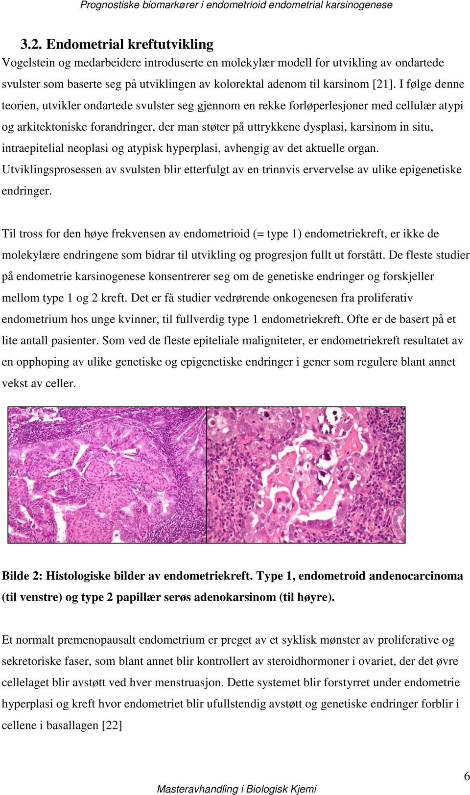 intraepitelial neoplasi og atypisk hyperplasi, avhengig av det aktuelle organ. Utviklingsprosessen av svulsten blir etterfulgt av en trinnvis ervervelse av ulike epigenetiske endringer.