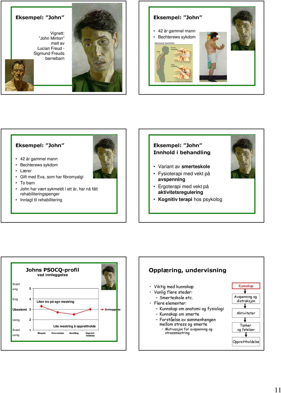 Fysioterapi med vekt på avspenning Ergoterapi med vekt på aktivitetsregulering Kognitiv terapi hos psykolog Johns PSOCQ-profil ved innleggelse Opplæring, undervisning Svært enig Enig Ubestemt Uenig