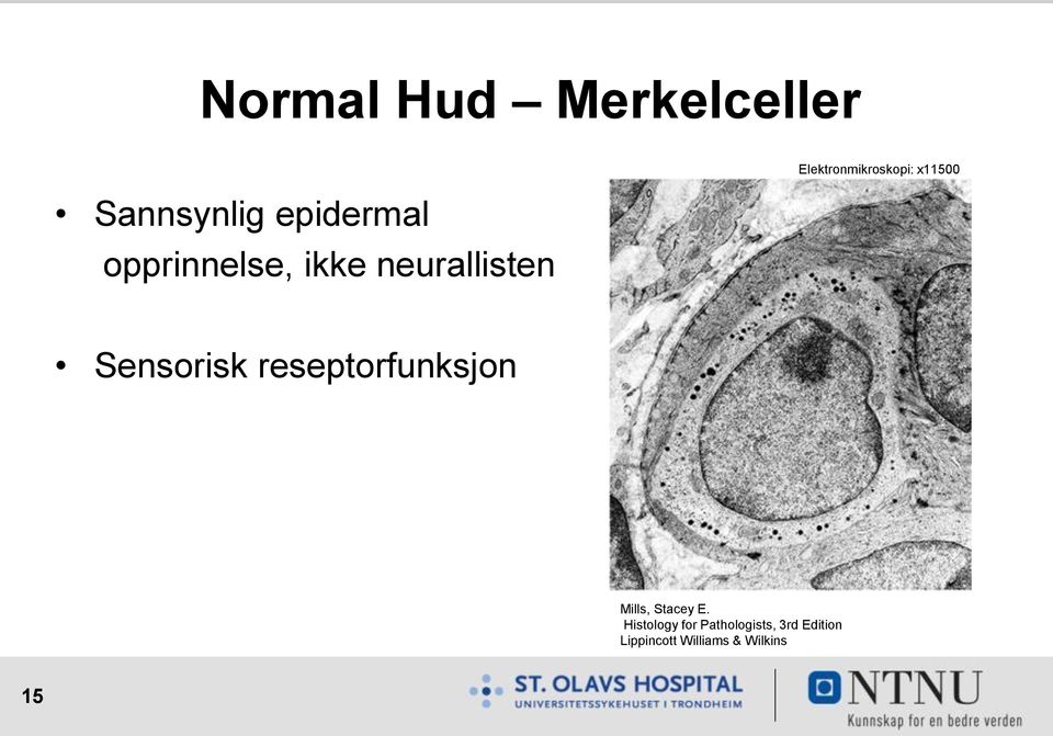 x11500 Sensorisk reseptorfunksjon Mills, Stacey E.