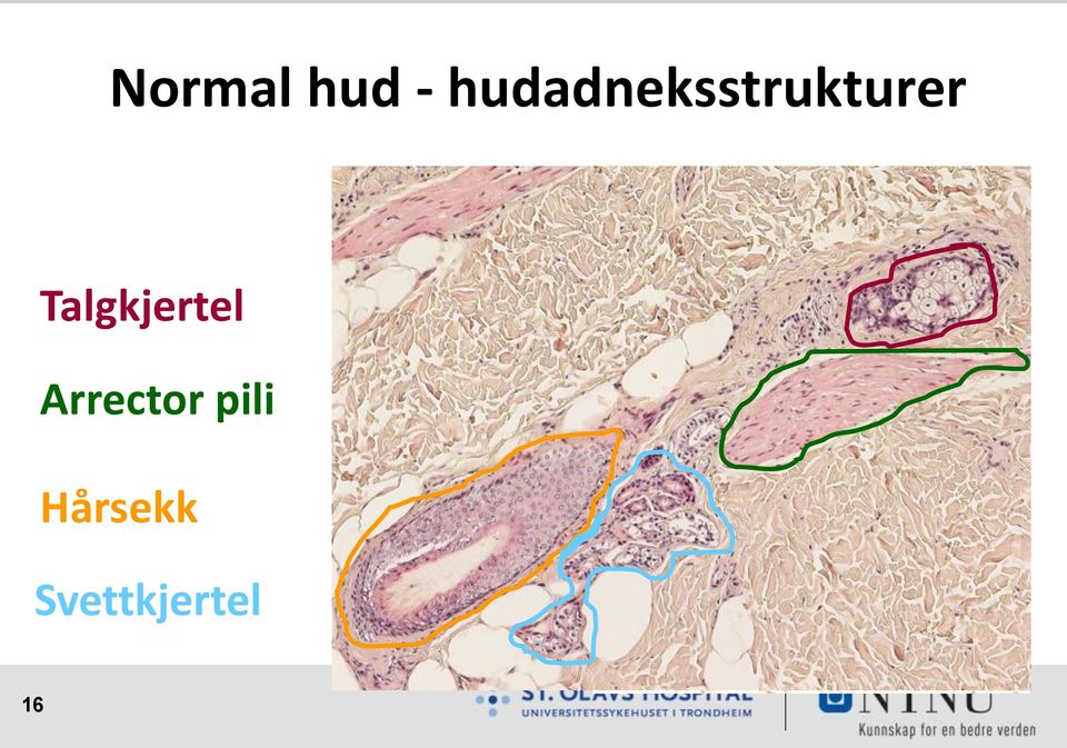 Talgkjertel Arrector