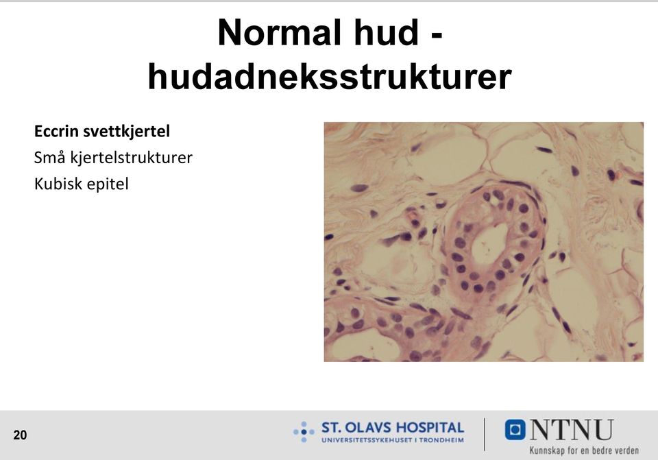 Eccrin svettkjertel