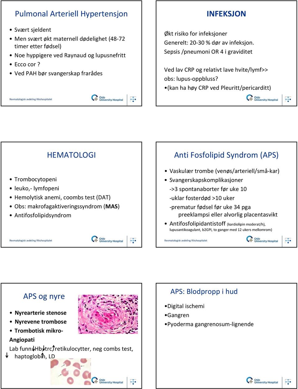 Sepsis /pneumoni OR 4 i graviditet Ved lav CRP og relativt lave hvite/lymf>> obs: lupus oppbluss?