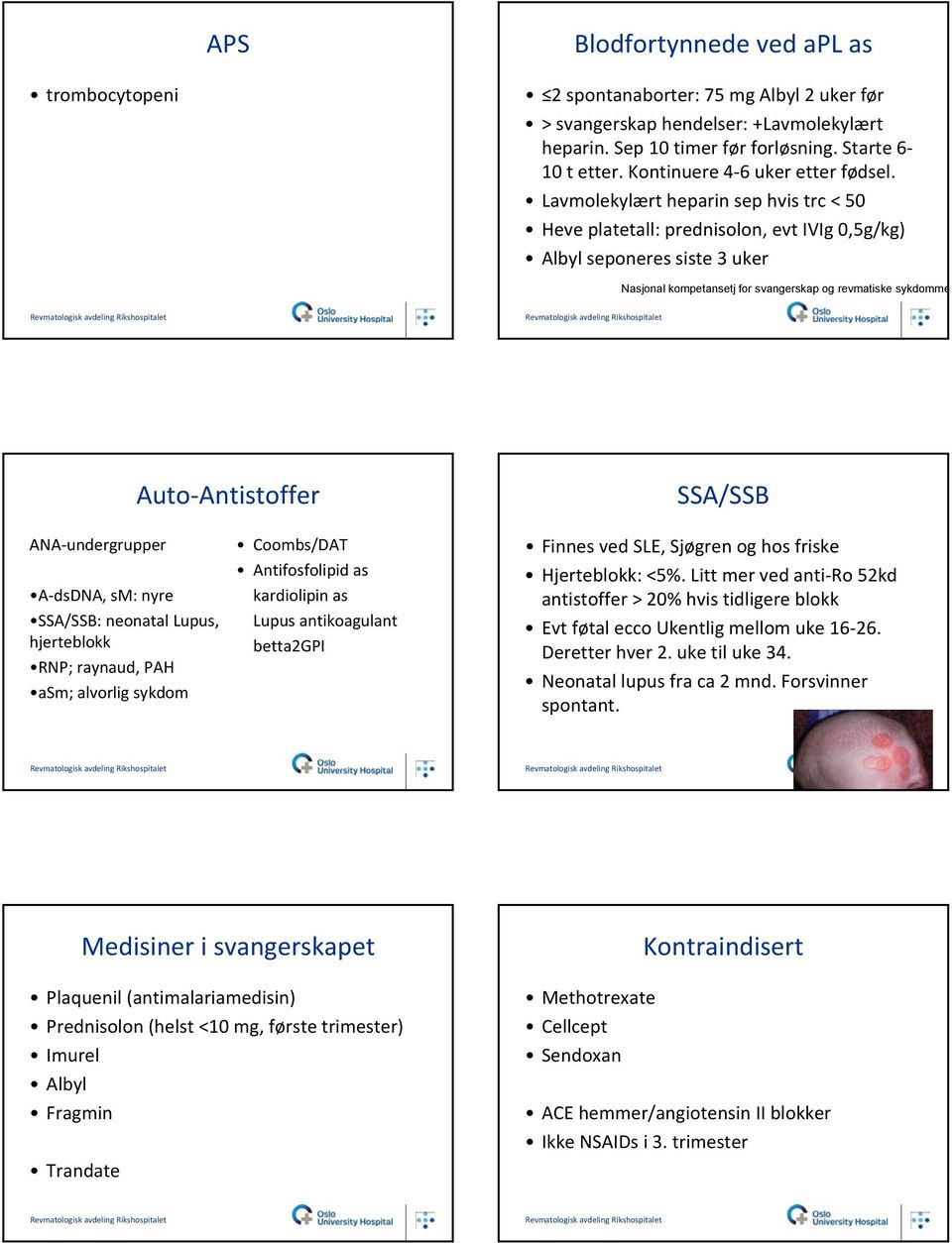 Lavmolekylært heparin sep hvis trc < 50 Heve platetall: prednisolon, evt IVIg 0,5g/kg) Albyl seponeres siste 3 uker Nasjonal kompetansetj for svangerskap og revmatiske sykdomme Auto Antistoffer