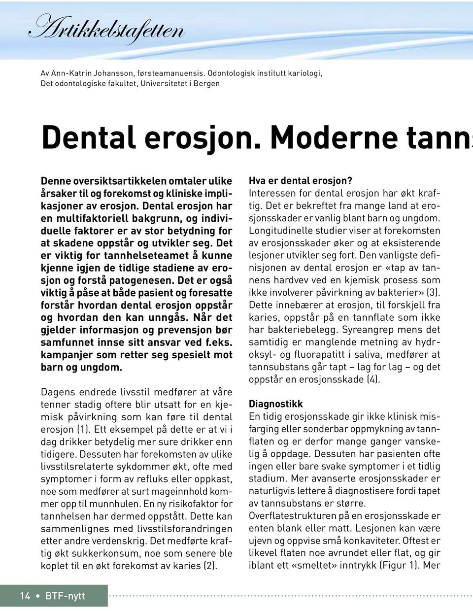 Dental erosjon har en multifaktoriell bakgrunn, og individuelle faktorer er av stor betydning for at skadene oppstår og utvikler seg.