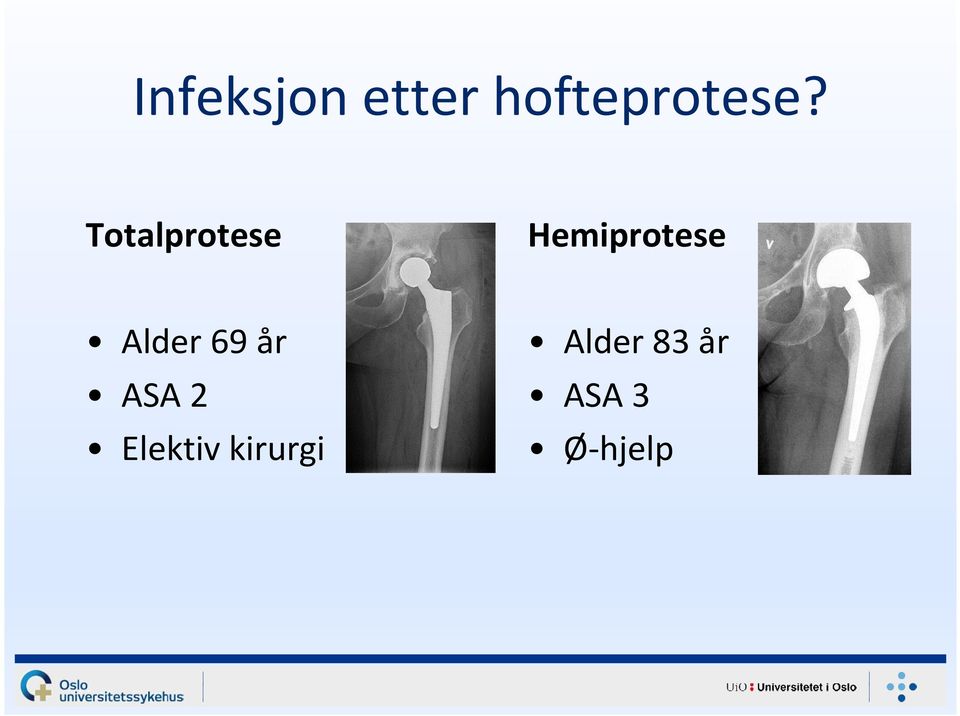 Alder 69 år ASA 2 Elektiv