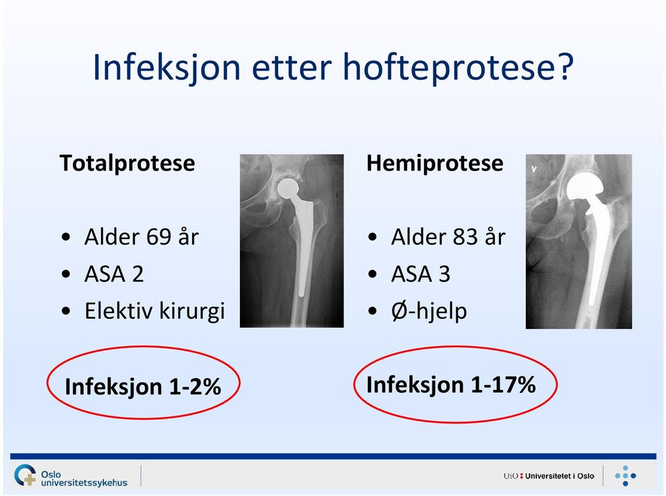 ASA 2 Elektiv kirurgi Alder 83 år