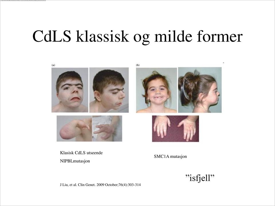 SMC1A mutasjon J Liu, et al.