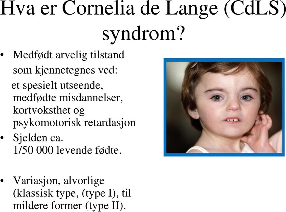 kortvoksthet og psykomotorisk retardasjon Sjelden ca.