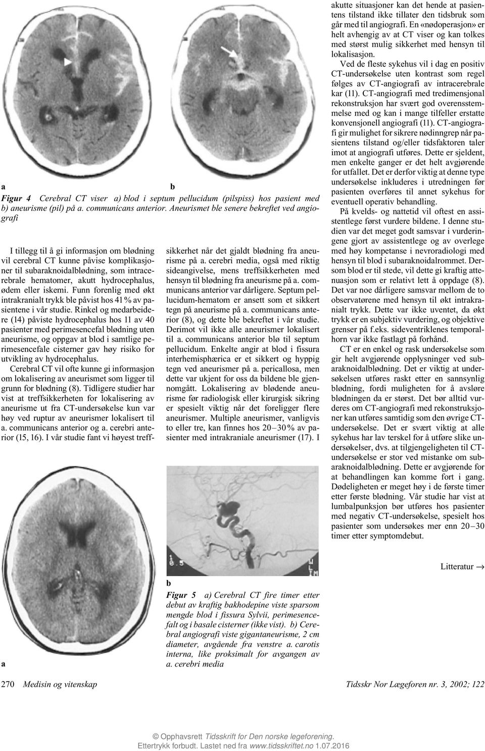 hydrocephalus, ødem eller iskemi. Funn forenlig med økt intrakranialt trykk le påvist hos 41% av pasientene i vår studie.