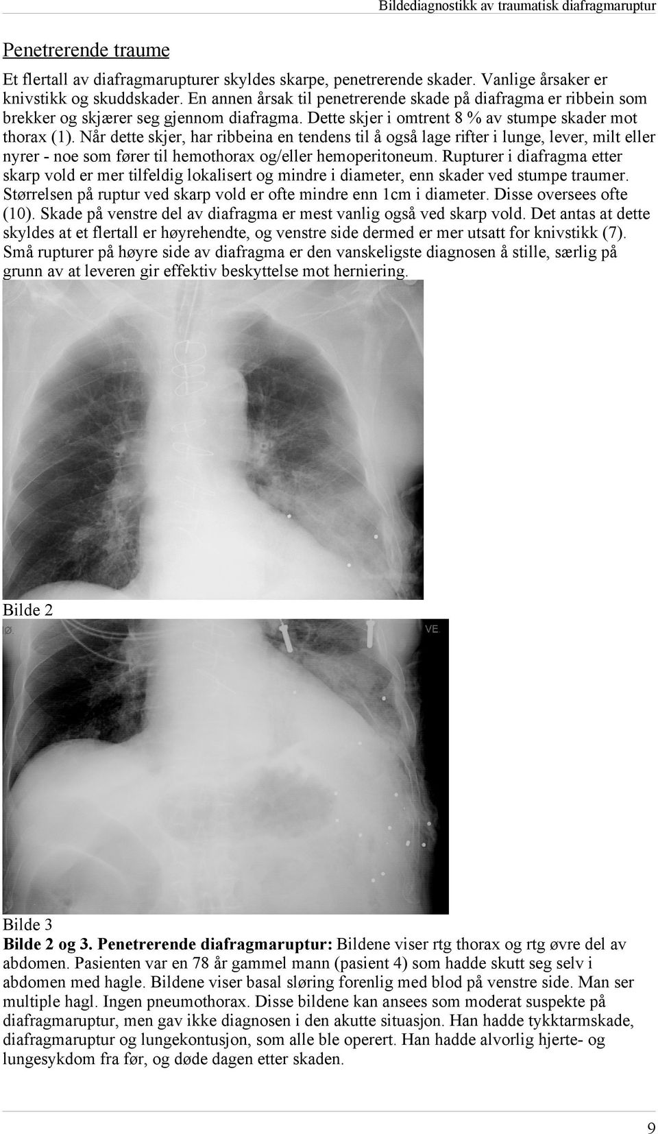 Når dette skjer, har ribbeina en tendens til å også lage rifter i lunge, lever, milt eller nyrer noe som fører til hemothorax og/eller hemoperitoneum.