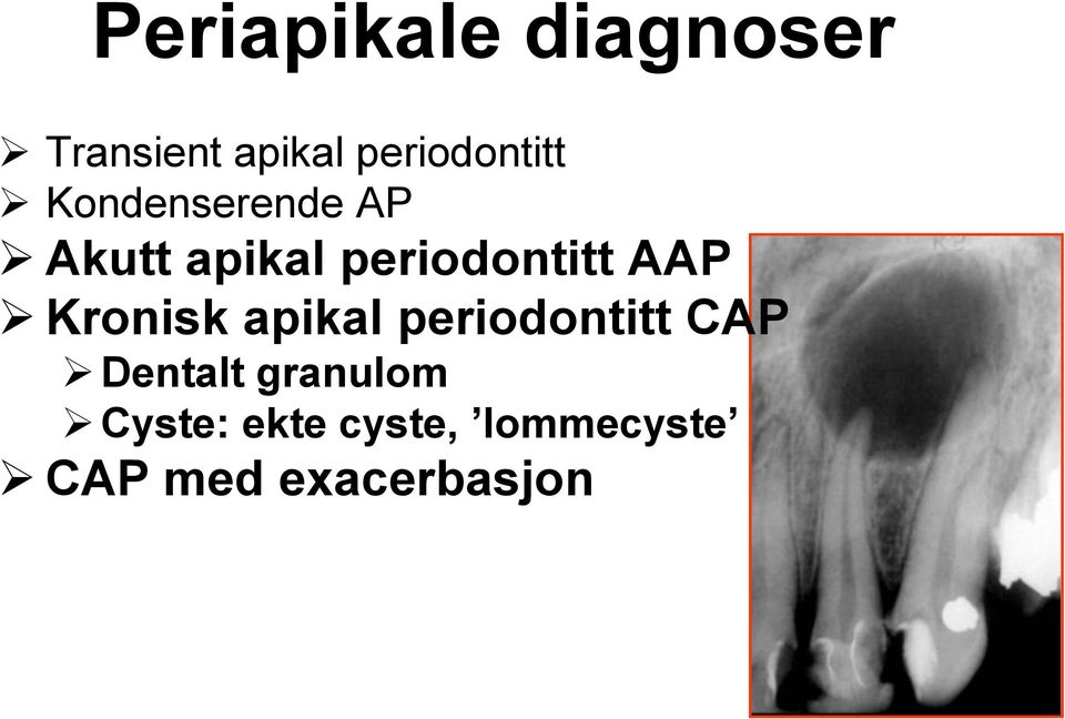 periodontitt AAP Kronisk apikal periodontitt CAP