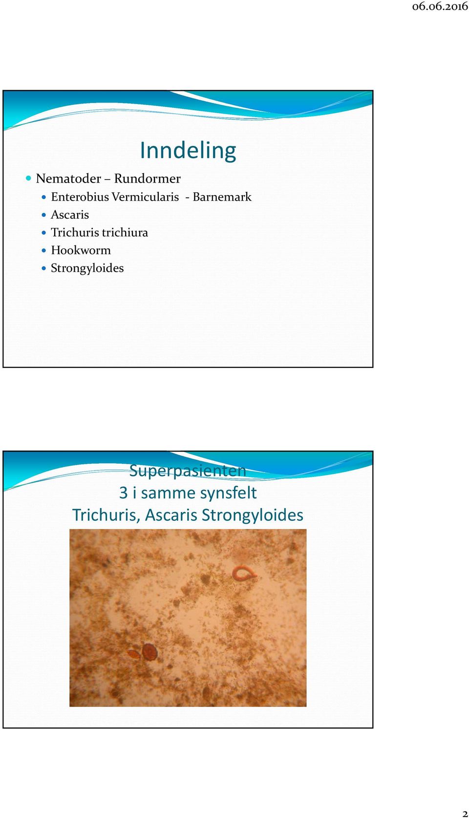 trichiura Hookworm Strongyloides