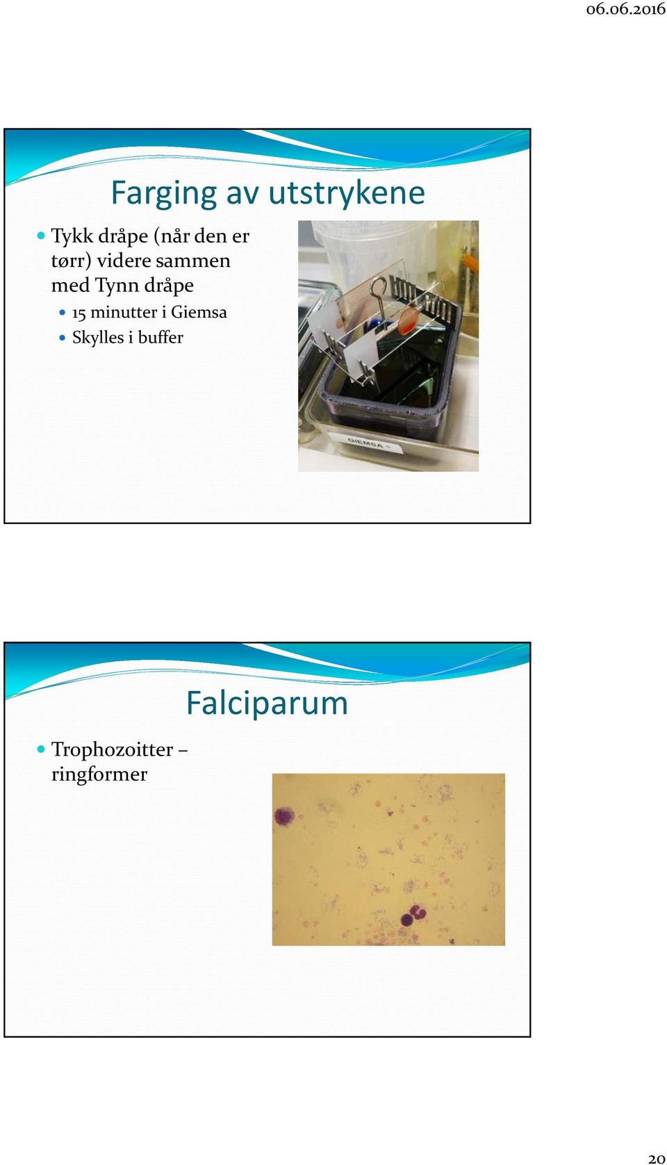 dråpe 15 minutter i Giemsa Skylles i