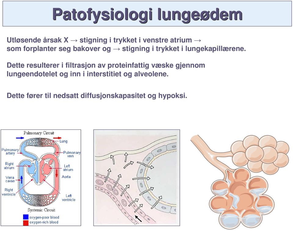 Dette resulterer i filtrasjon av proteinfattig væske gjennom lungeendotelet og