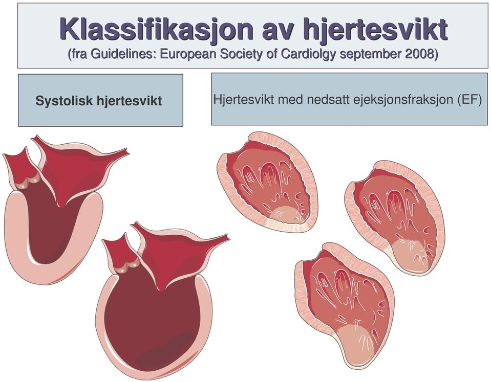 Cardiolgy september 2008) Systolisk