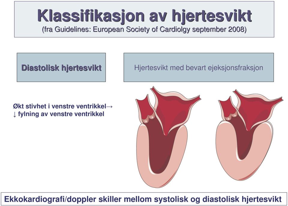 ejeksjonsfraksjon Økt stivhet i venstre ventrikkel fylning av venstre