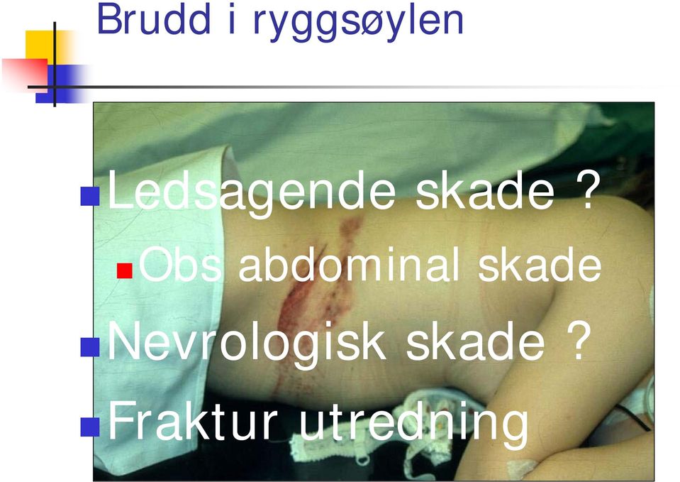 Obs abdominal skade