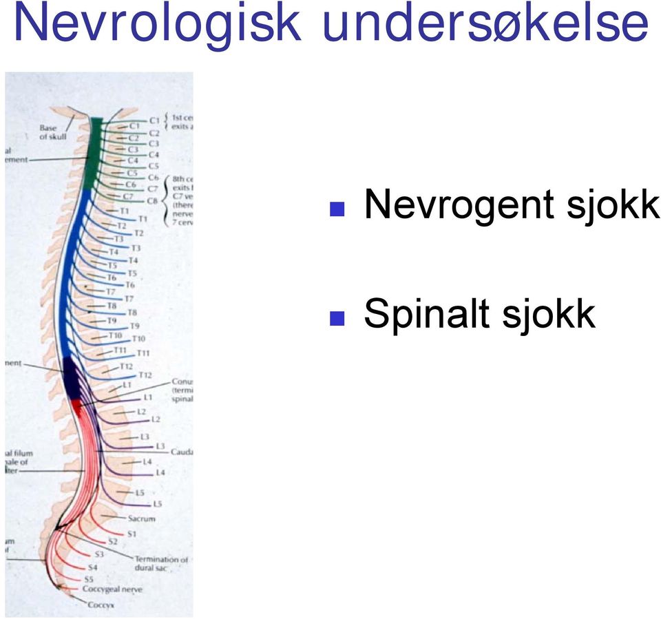 Nevrogent