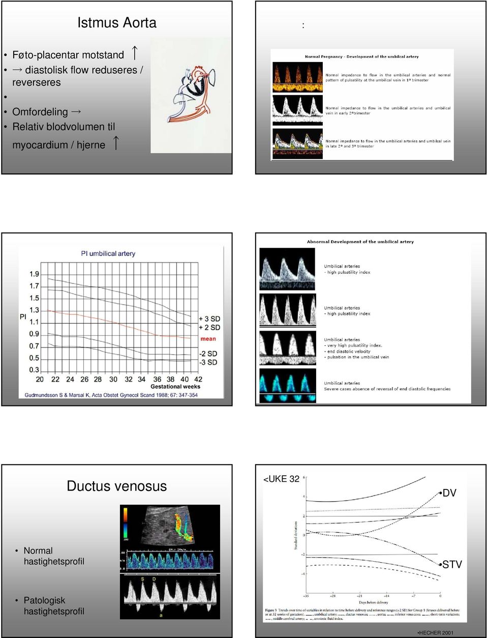 til myocardium / hjerne Ductus venosus <UKE 32 DV Normal