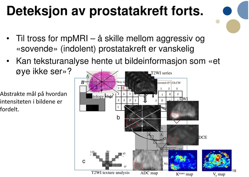 bildeinformasjon som «et øye ikke ser»? T2WI series Abstrakte mål på hvordan intensiteten i bildene er fordelt.